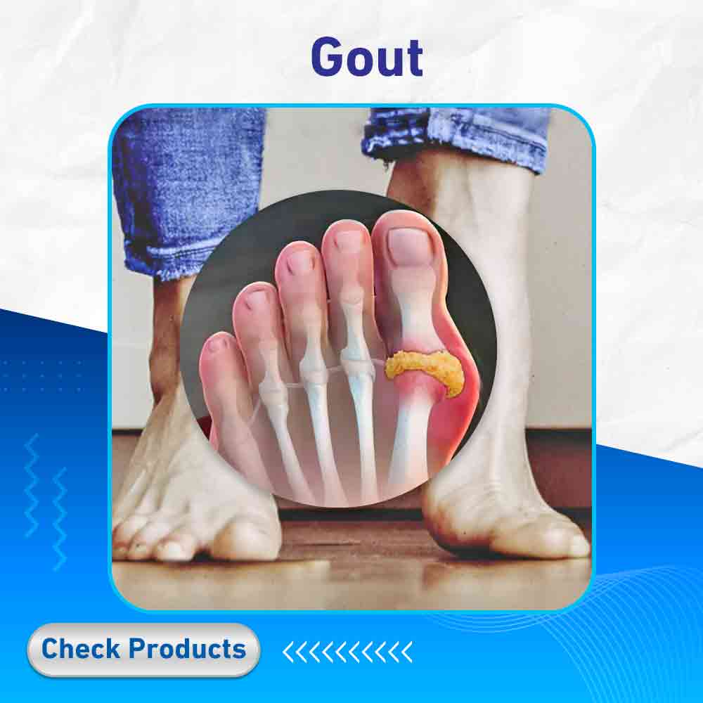 gout - Life Care Pharmacy