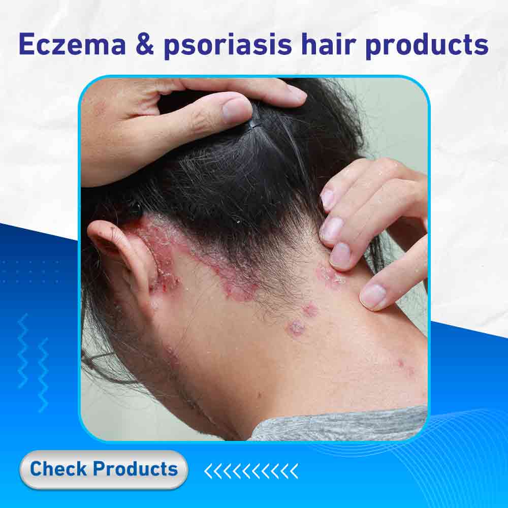 Eczema & psoriasis hair products - Life Care Pharmacy