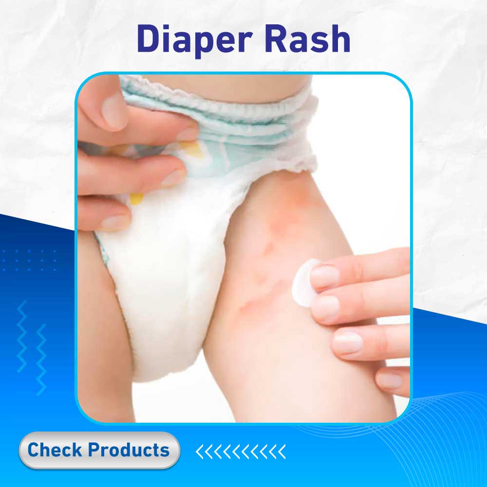 Diaper Rash - Life Care Pharmacy